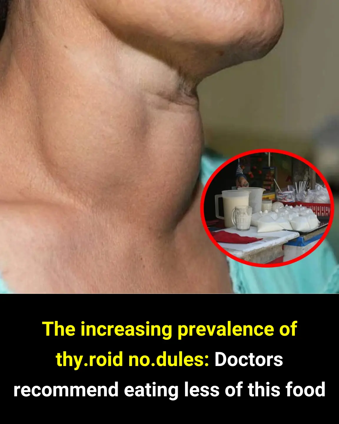 “Hidden Threats to Your Thyroid: What Doctors Say to Avoid”