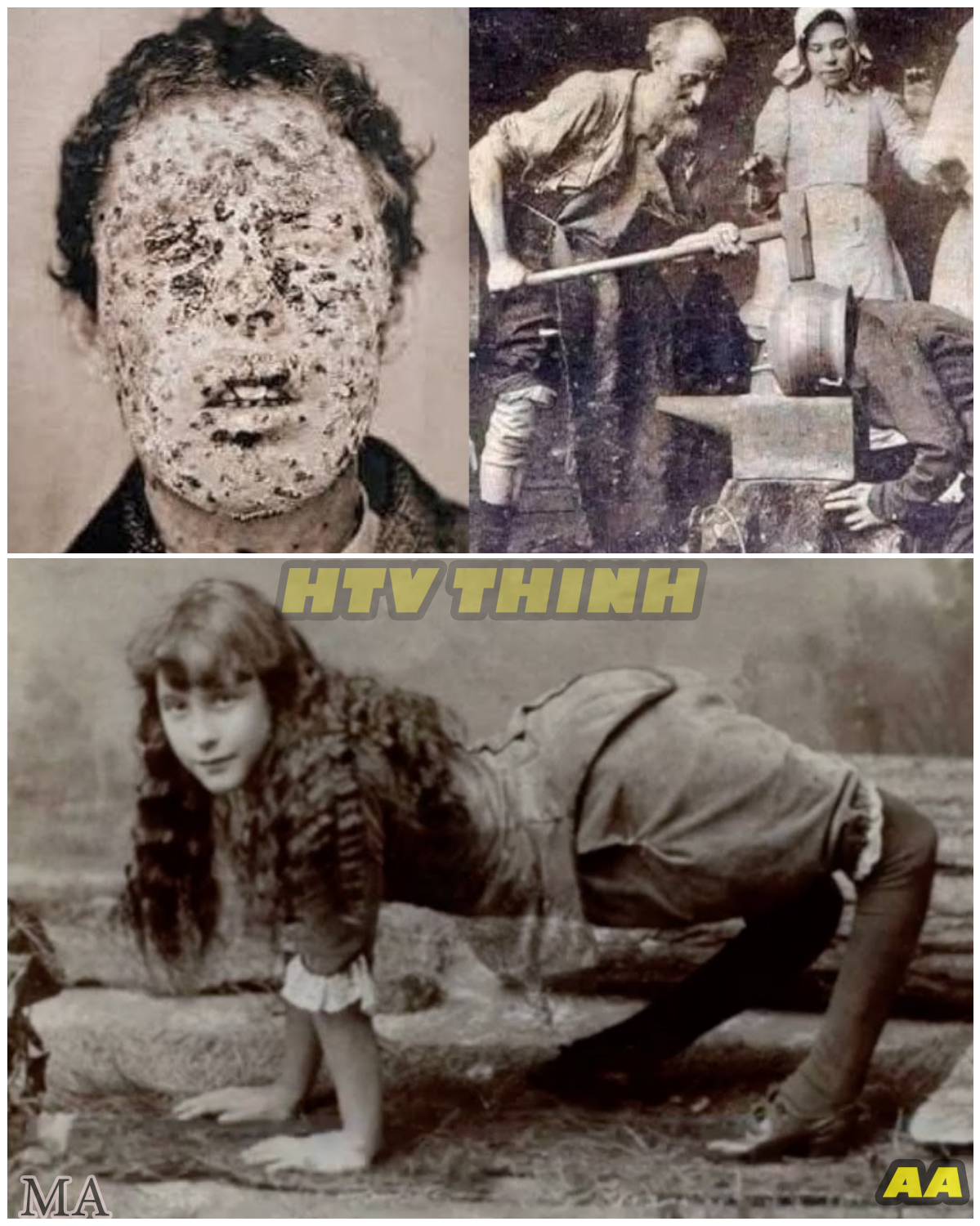  Shocking Rare Photos of 25 Legendary Sideshow Performers — Hidden Stories and Scandals the World Was Never Meant to See!  - News