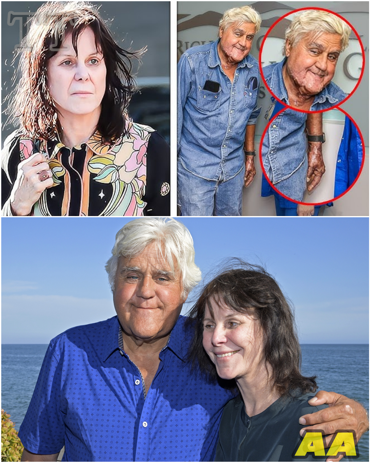 Jay Leno’s Wife Breaks Down After His Heartbreaking Diagnosis - News