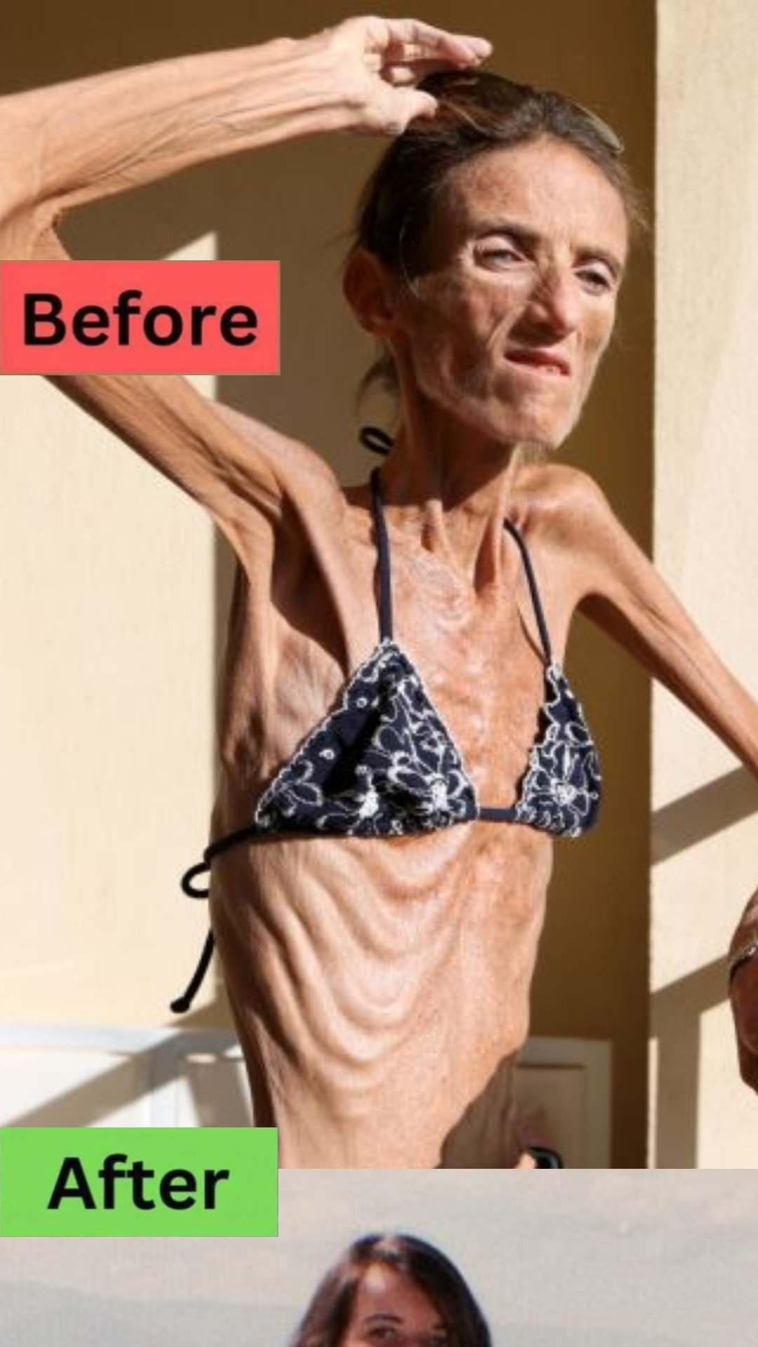OMG THE WORLD’S THINNEST WOMAN’S