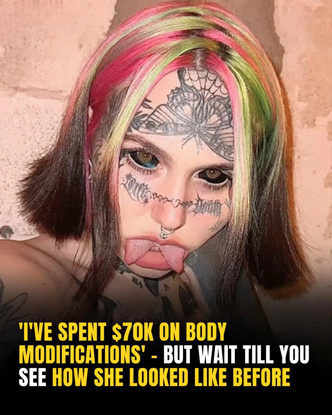 After $70,000 In Body Alterations, She Faces Criticism — But Embraces Her True Beauty