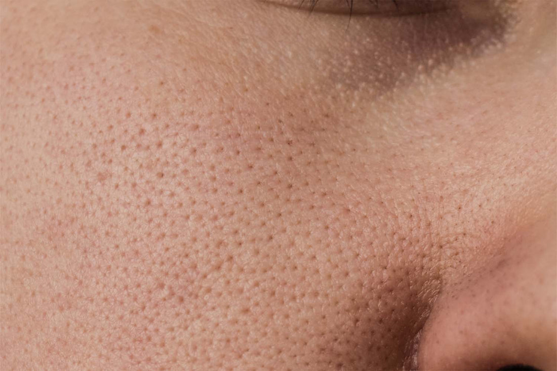 Why You Should Never Sleep With Makeup On
