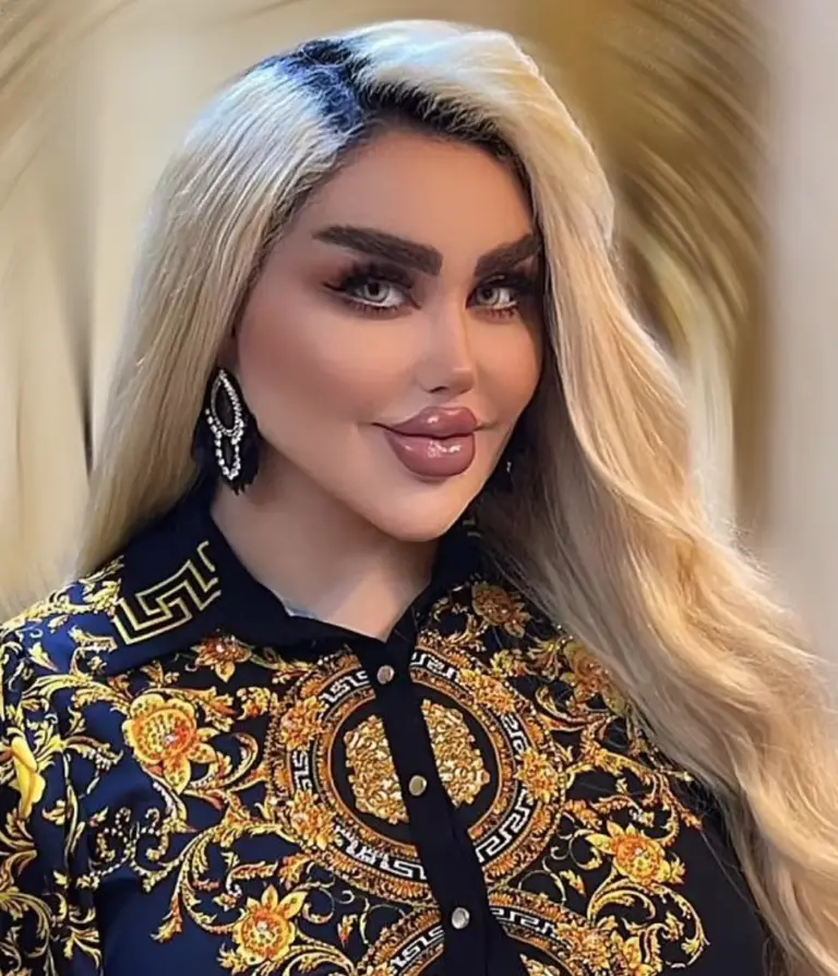 She Had 43 Cosmetic Procedures To Become A Barbie Doll – Critics Say She Looks Like A ‘Zombie’
