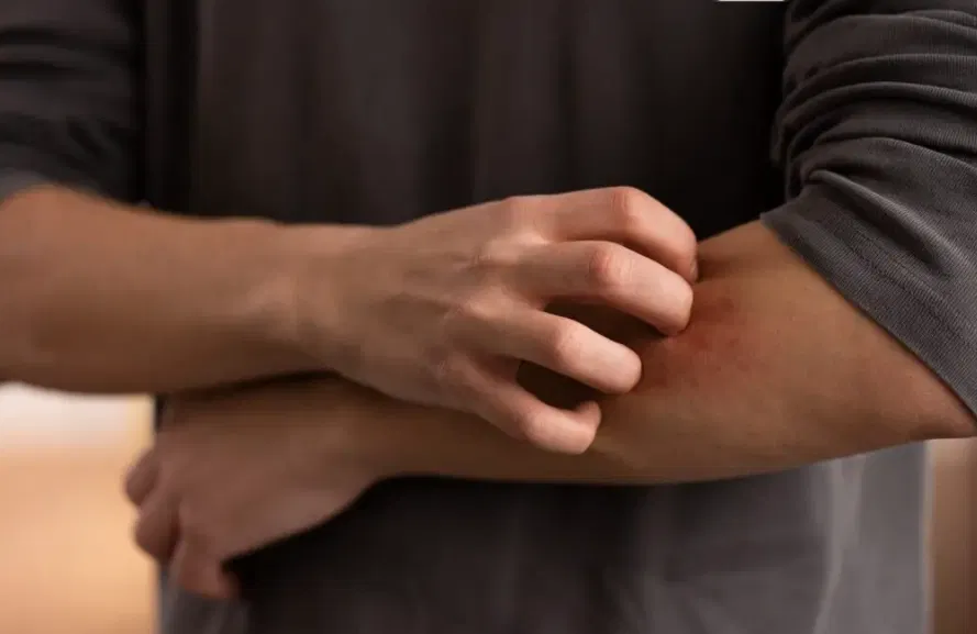 Don’t overlook these small red spots on your arm – They could be important w.arning signs