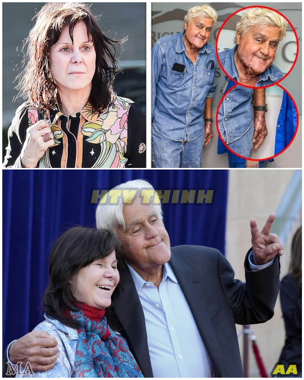 “Tears Behind the Garage Doors — Jay Leno’s Wife Breaks Down After His Heartbreaking Diagnosis, the Private Battle the Comedian Tried to Keep Hidden From the World ” - News