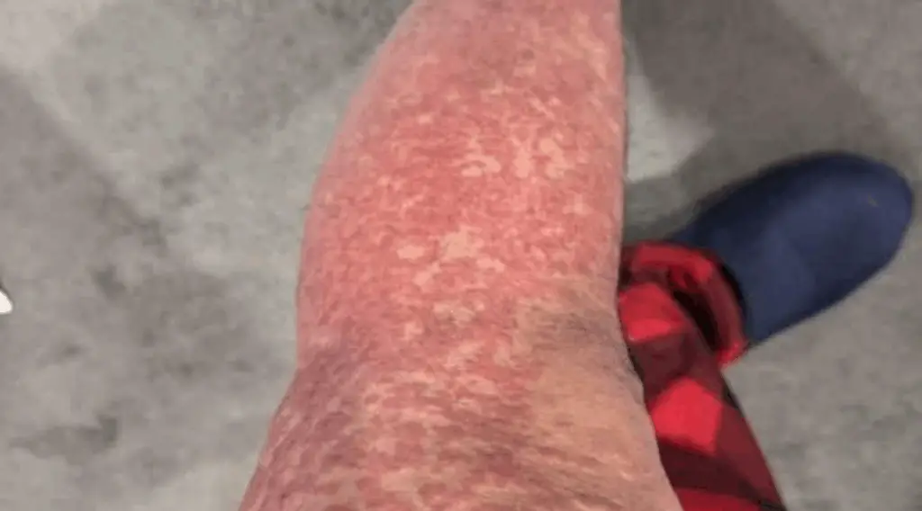 What Your Skin Could Be Telling You About Hidden Health Issues
