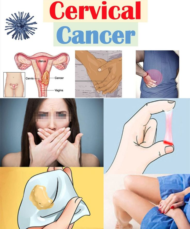12 Early Signs Your Uterus May Be Asking for Help – Don’t Overlook These Signals (on3)
