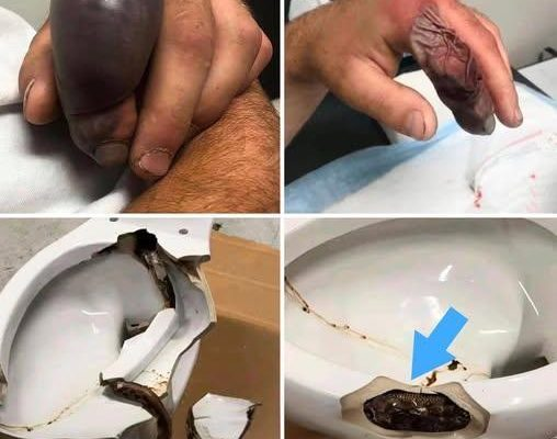 In several regions, people were attacked while using their bathrooms.