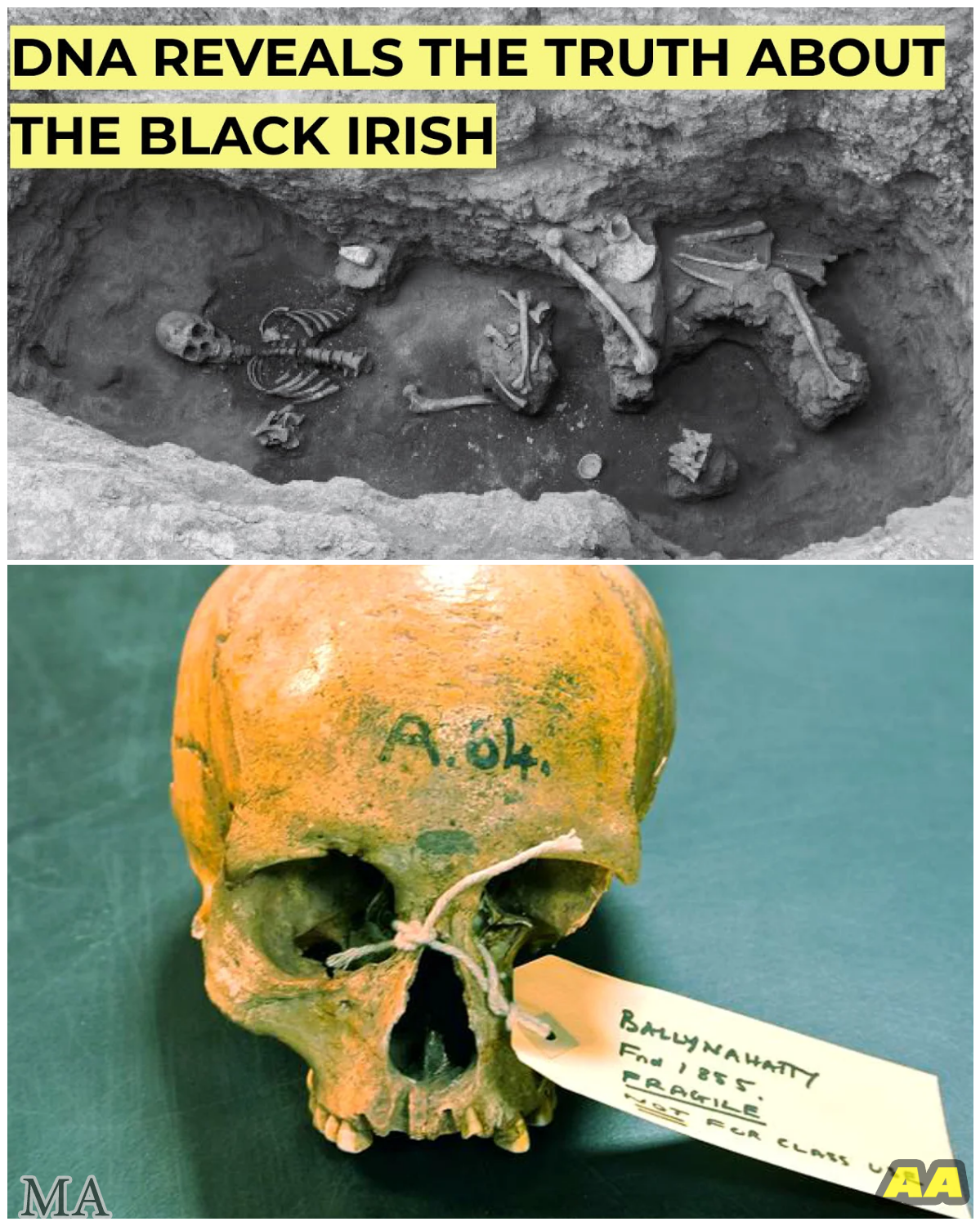  Ancient Irish DNA Finally Reveals the Shocking True Origins of Hazel Eyes – Scientists Say History Is Completely Wrong  - News