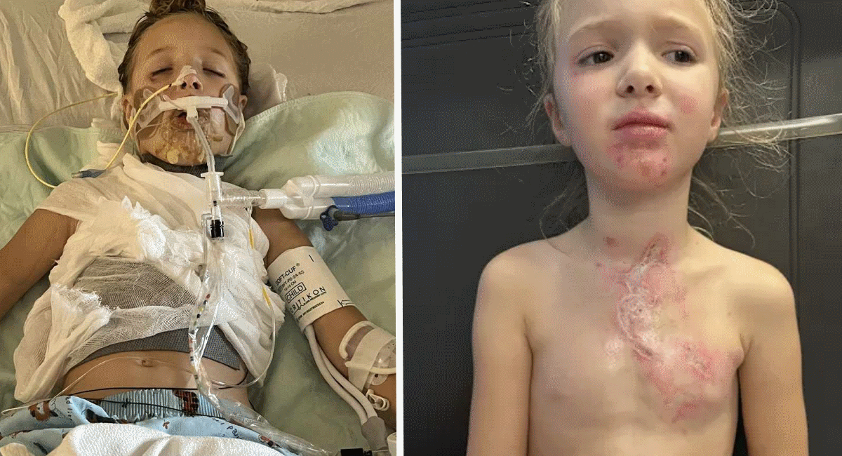 Girl, 7, Left in Coma After Toy Explodes in Her Face During Online Trend — Family Blames Social Media ‘Madness’