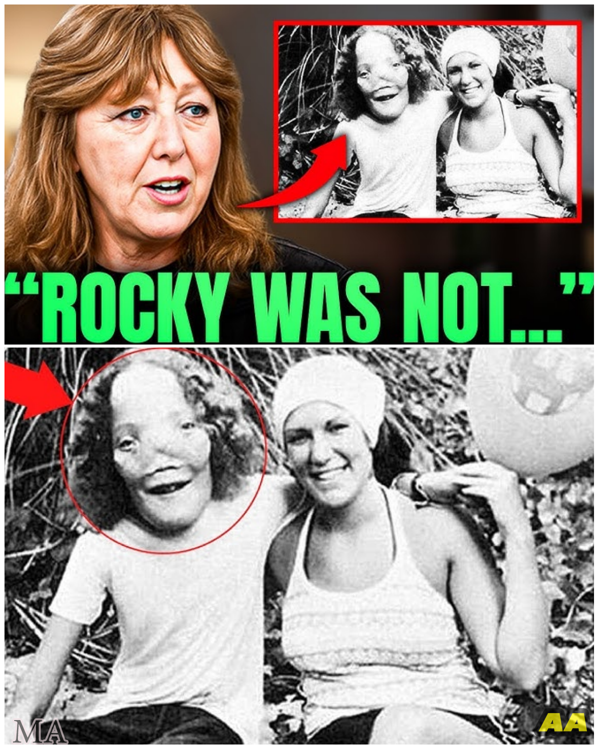  Rocky Dennis’s Mother Finally Reveals Shocking Truth About Her Son Before Her Death – What She Said Will Leave You Speechless!  - News